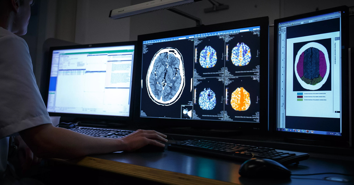 Medical Delta Diagnostics 3.0: Dementia and Stroke | Medical Delta